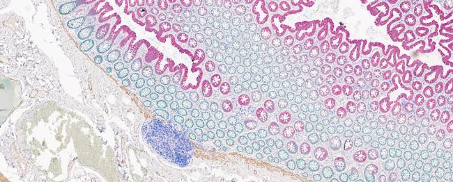 Colon tissue stained using the BOND RX and imaged with an Aperio digital pathology scanner.